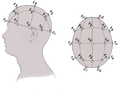 Seizure anticipation